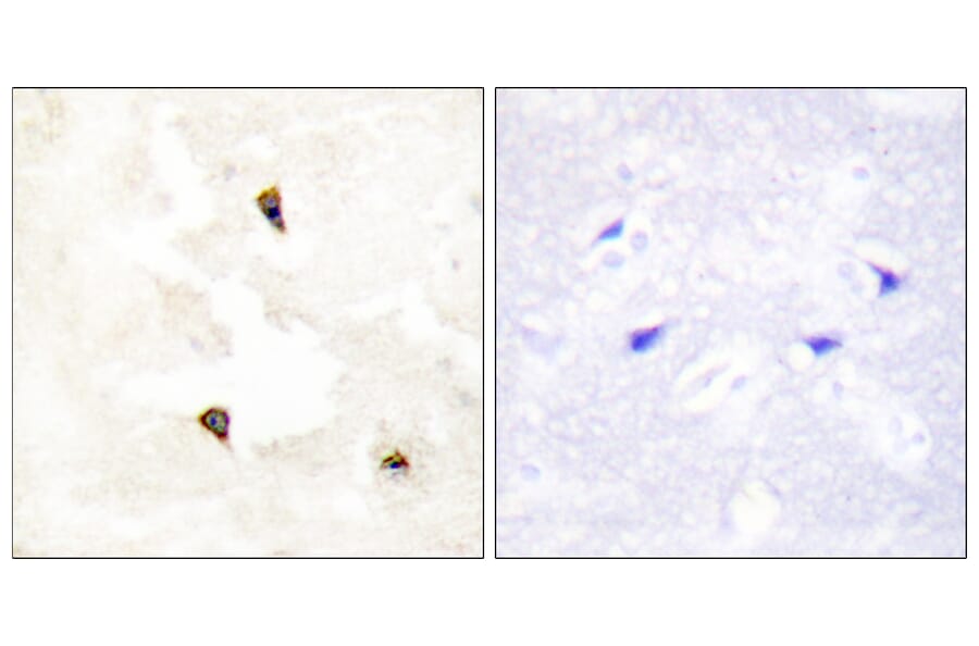 Immunohistochemistry - Anti-TP53I11 Antibody (C10041) - Antibodies.com