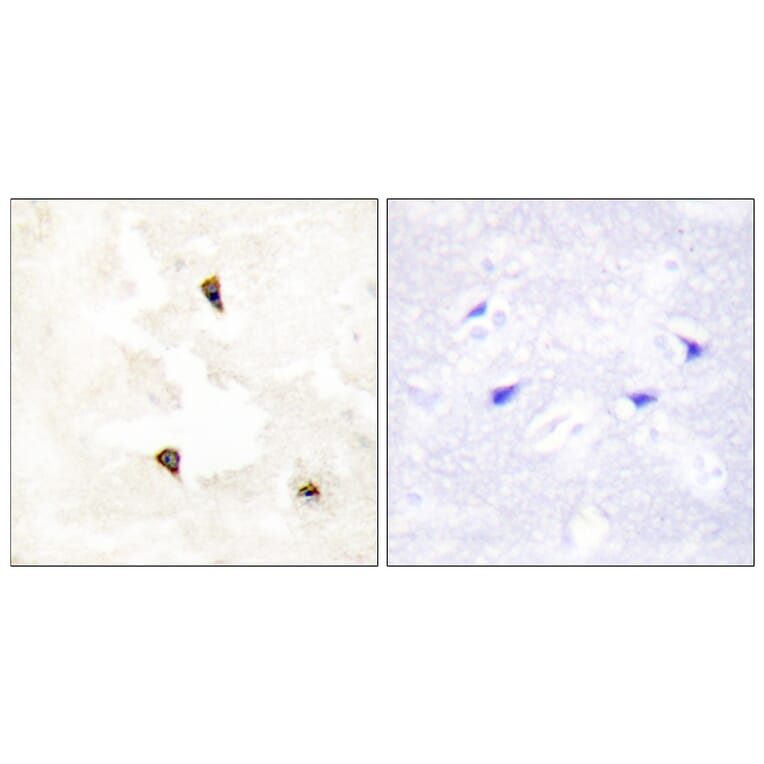 Immunohistochemistry - Anti-TP53I11 Antibody (C10041) - Antibodies.com