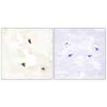 Immunohistochemistry - Anti-TP53I11 Antibody (C10041) - Antibodies.com