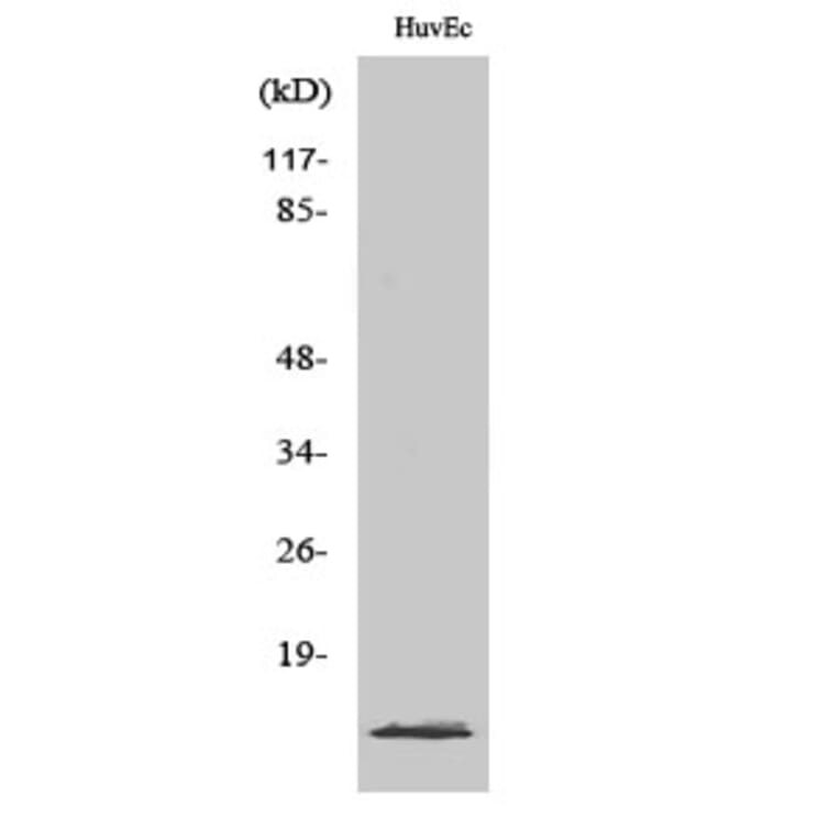 Western Blot - Anti-TP53I11 Antibody (C10041) - Antibodies.com