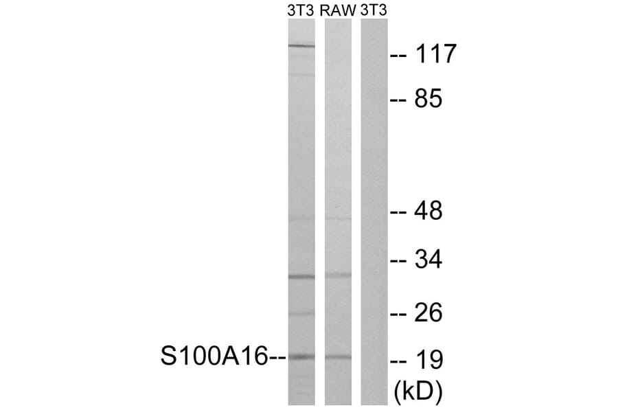 Western Blot - Anti-S100A16 Antibody (C18044) - Antibodies.com