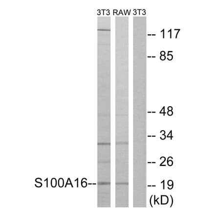 Western Blot - Anti-S100A16 Antibody (C18044) - Antibodies.com