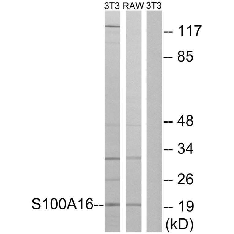 Western Blot - Anti-S100A16 Antibody (C18044) - Antibodies.com