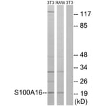 Western Blot - Anti-S100A16 Antibody (C18044) - Antibodies.com