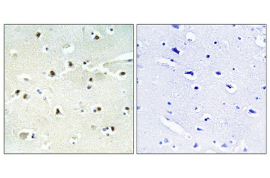 Immunohistochemistry - Anti-S100A16 Antibody (C18044) - Antibodies.com