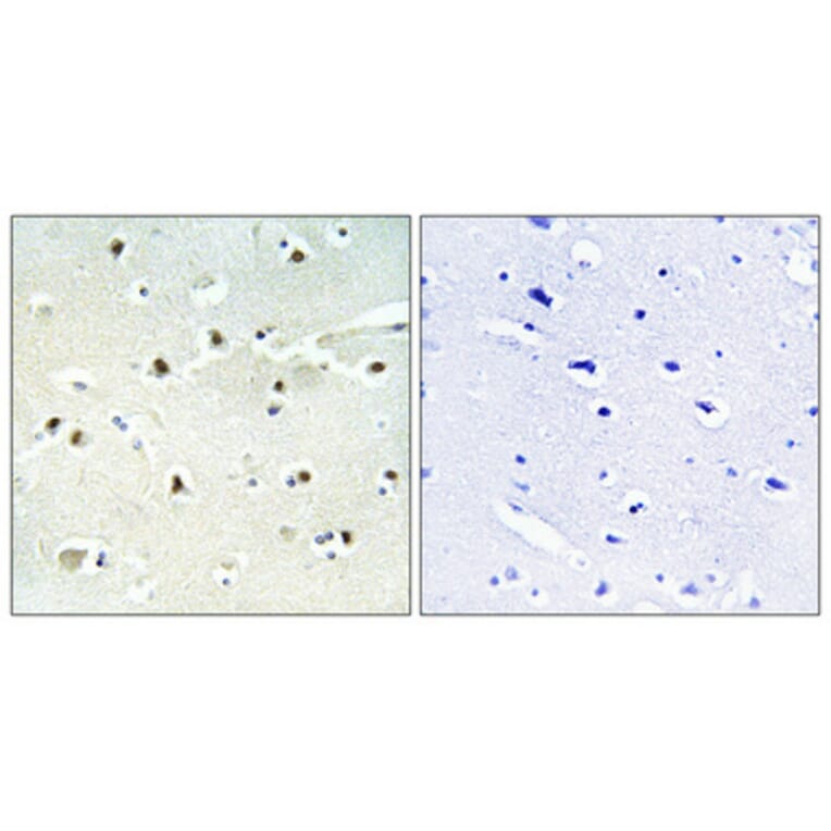 Immunohistochemistry - Anti-S100A16 Antibody (C18044) - Antibodies.com