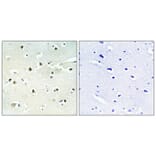 Immunohistochemistry - Anti-S100A16 Antibody (C18044) - Antibodies.com