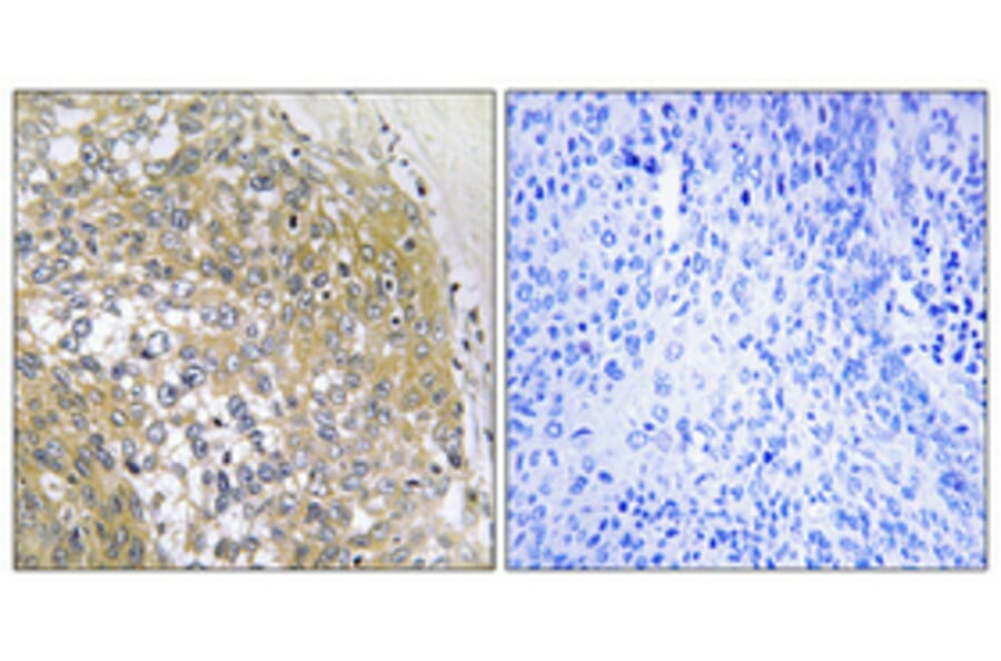 Immunohistochemistry - Anti-S100A16 Antibody (C18044) - Antibodies.com