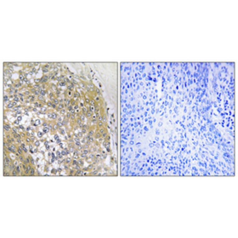 Immunohistochemistry - Anti-S100A16 Antibody (C18044) - Antibodies.com