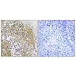 Immunohistochemistry - Anti-S100A16 Antibody (C18044) - Antibodies.com