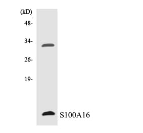 Western Blot - Anti-S100A16 Antibody (R12-3474) - Antibodies.com