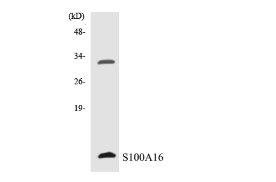Western Blot - Anti-S100A16 Antibody (R12-3474) - Antibodies.com