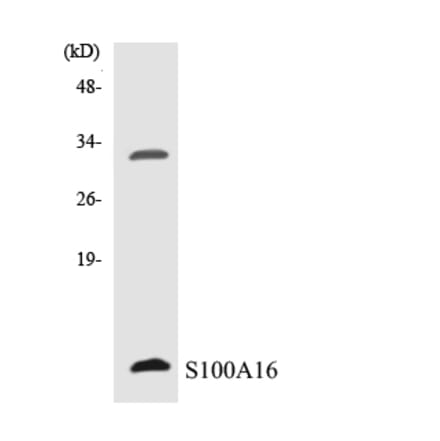 Western Blot - Anti-S100A16 Antibody (R12-3474) - Antibodies.com