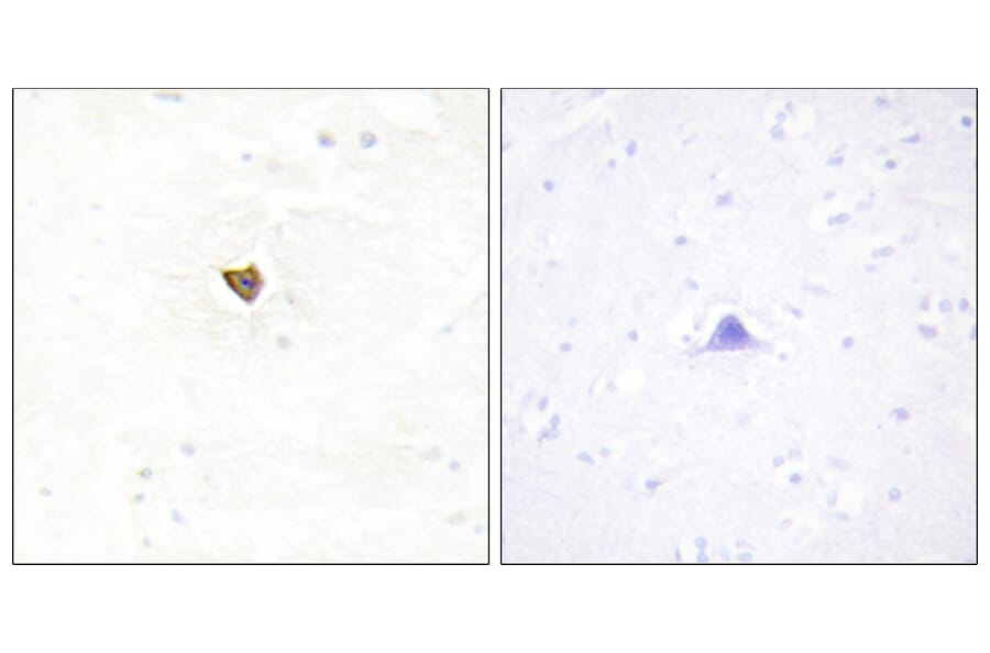 Immunohistochemistry - Anti-JAKMIP2 Antibody (C11472) - Antibodies.com