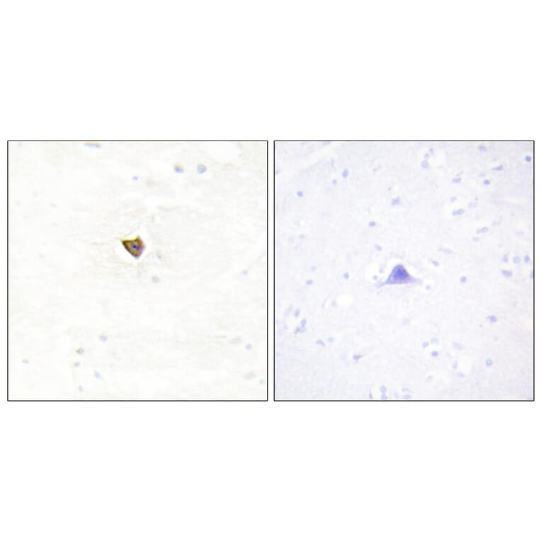 Immunohistochemistry - Anti-JAKMIP2 Antibody (C11472) - Antibodies.com