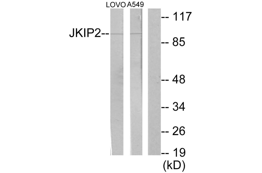 Western Blot - Anti-JAKMIP2 Antibody (C11472) - Antibodies.com