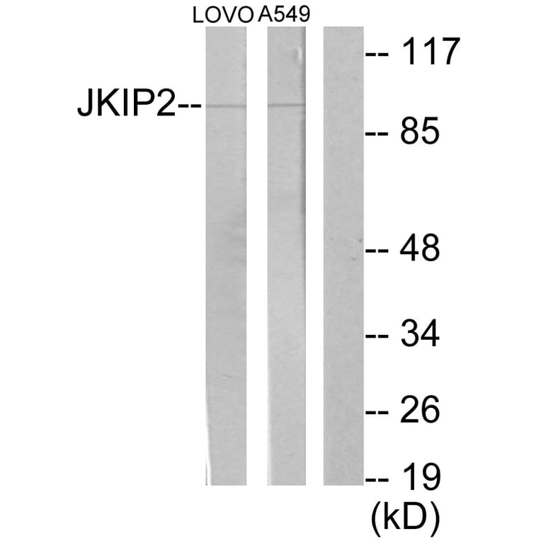Western Blot - Anti-JAKMIP2 Antibody (C11472) - Antibodies.com