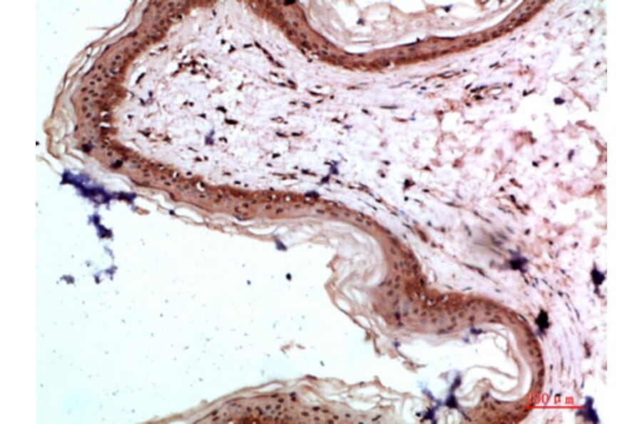 Immunohistochemistry - Anti-COL17A1 Antibody (C31075) - Antibodies.com