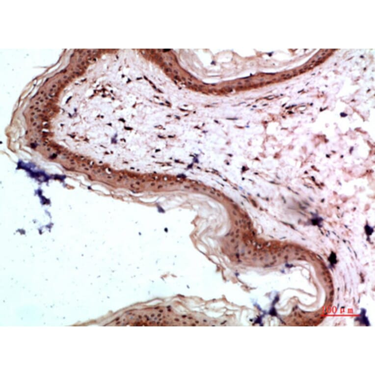 Immunohistochemistry - Anti-COL17A1 Antibody (C31075) - Antibodies.com