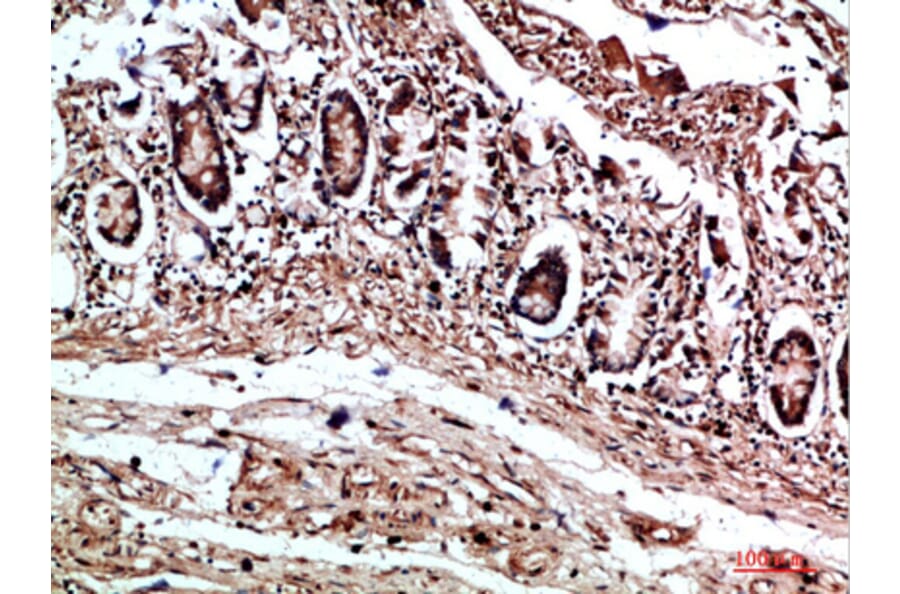 Immunohistochemistry - Anti-COL17A1 Antibody (C31075) - Antibodies.com