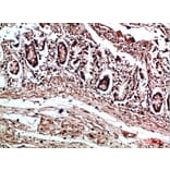 Immunohistochemistry - Anti-COL17A1 Antibody (C31075) - Antibodies.com