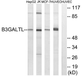 Western Blot - Anti-B3GALTL Antibody (C14717) - Antibodies.com