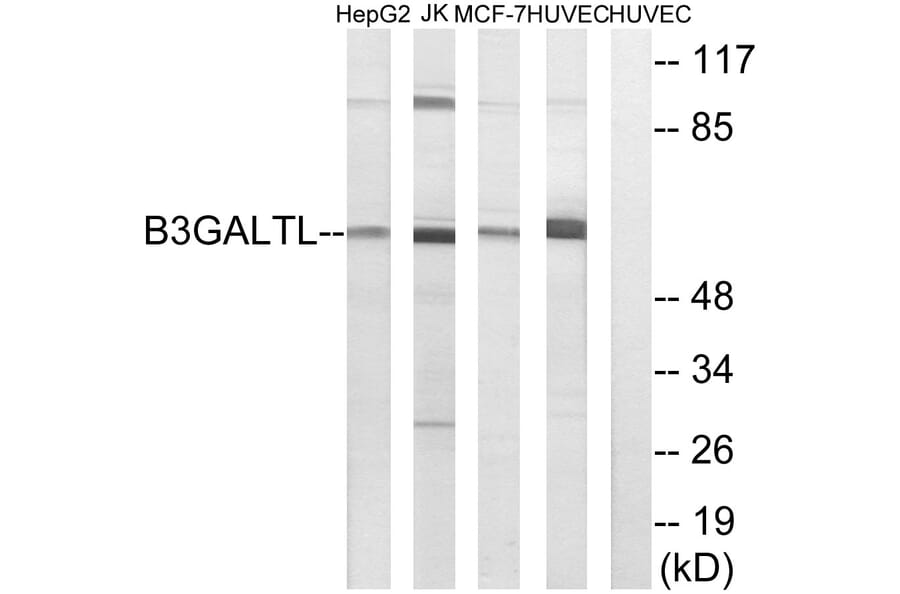 Western Blot - Anti-B3GALTL Antibody (C14717) - Antibodies.com