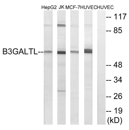 Western Blot - Anti-B3GALTL Antibody (C14717) - Antibodies.com