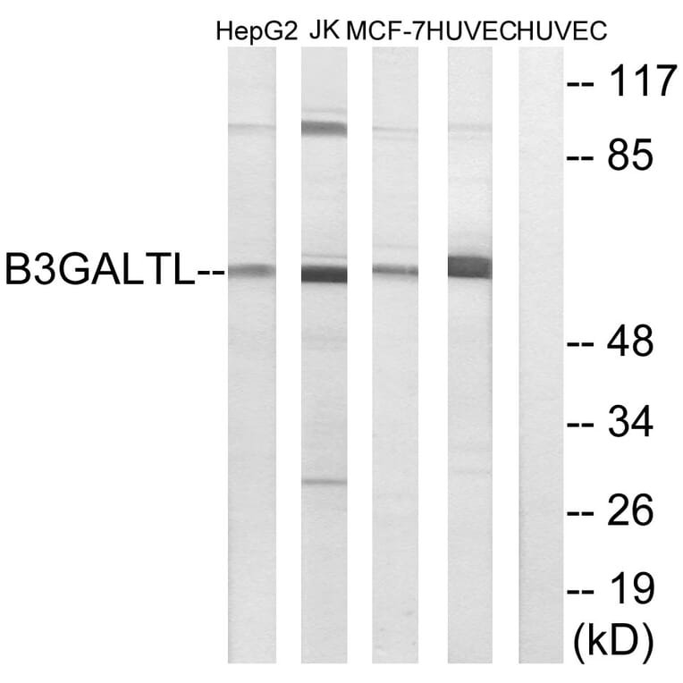 Western Blot - Anti-B3GALTL Antibody (C14717) - Antibodies.com