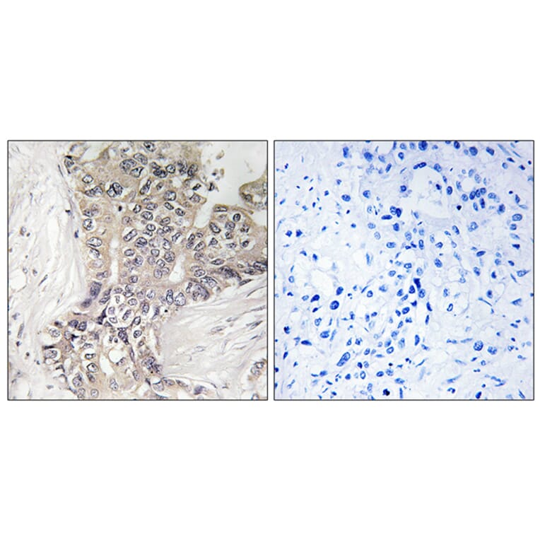 Immunohistochemistry - Anti-B3GALTL Antibody (C14717) - Antibodies.com
