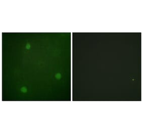 Immunofluorescence - Anti-Artemis Antibody (B0456) - Antibodies.com
