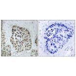 Immunohistochemistry - Anti-Artemis Antibody (B0456) - Antibodies.com