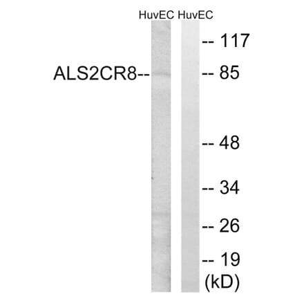 Western Blot - Anti-ALS2CR8 Antibody (C14463) - Antibodies.com