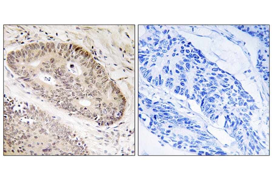 Immunohistochemistry - Anti-ALS2CR8 Antibody (C14463) - Antibodies.com