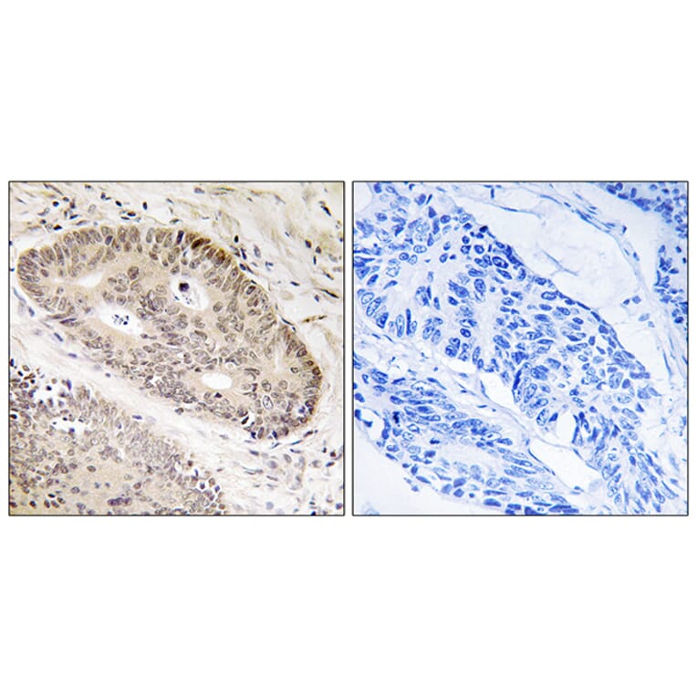 Immunohistochemistry - Anti-ALS2CR8 Antibody (C14463) - Antibodies.com