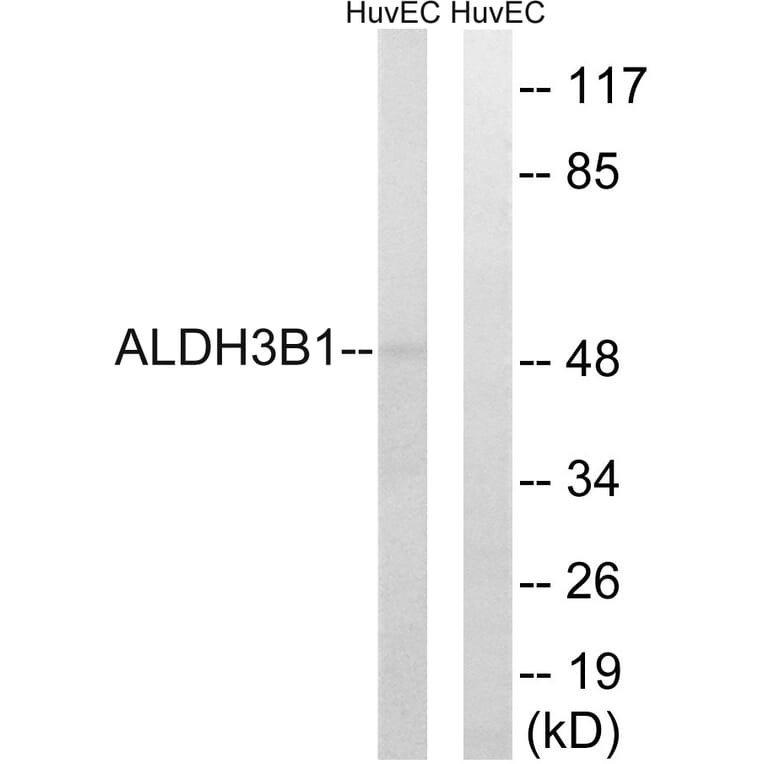 Western Blot - Anti-ALDH3B1 Antibody (C14386) - Antibodies.com