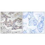 Immunohistochemistry - Anti-ALDH3B1 Antibody (C14386) - Antibodies.com