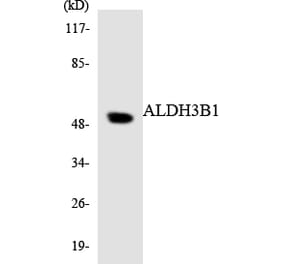 Western Blot - Anti-ALDH3B1 Antibody (R12-2475) - Antibodies.com