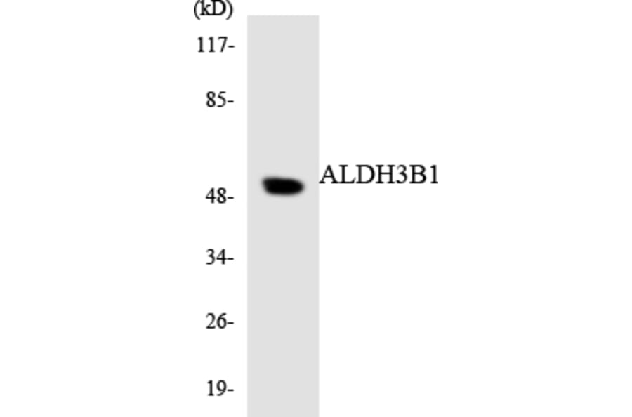 Western Blot - Anti-ALDH3B1 Antibody (R12-2475) - Antibodies.com