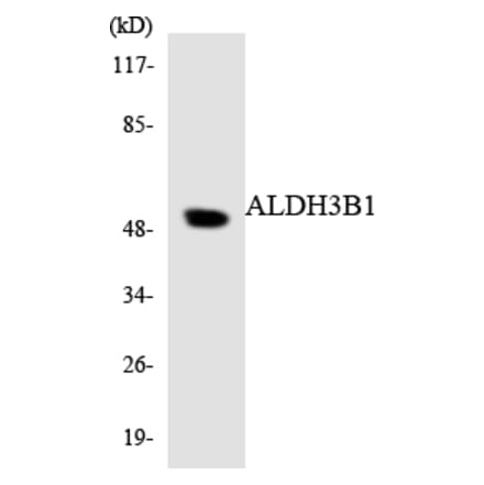 Western Blot - Anti-ALDH3B1 Antibody (R12-2475) - Antibodies.com