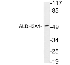 Western Blot - Anti-ALDH3A1 Antibody (R12-2017) - Antibodies.com