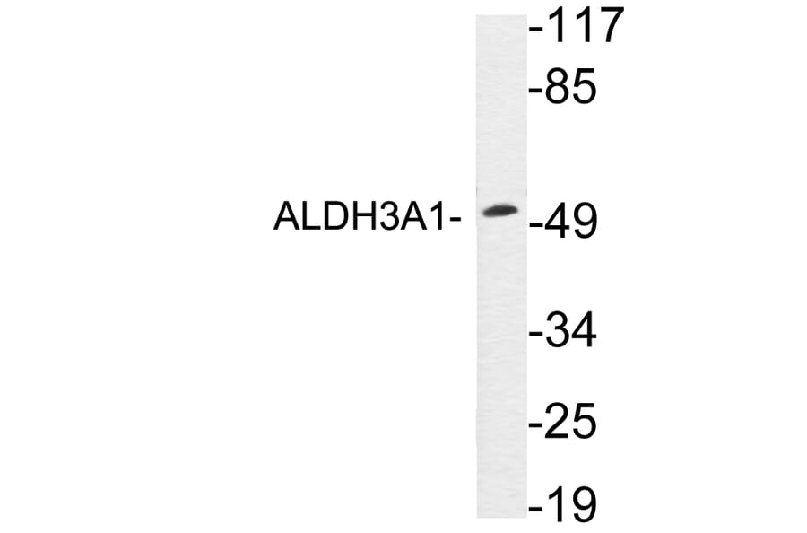Western Blot - Anti-ALDH3A1 Antibody (R12-2017) - Antibodies.com