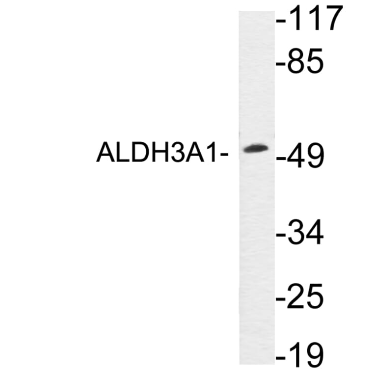 Western Blot - Anti-ALDH3A1 Antibody (R12-2017) - Antibodies.com