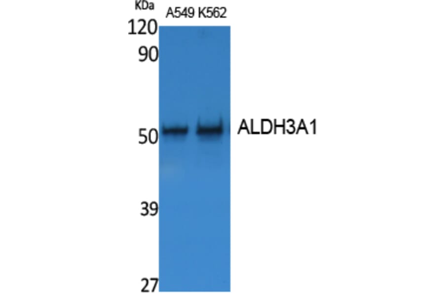 Western Blot - Anti-ALDH3A1 Antibody (R12-2017) - Antibodies.com