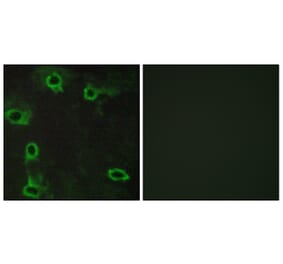 Immunofluorescence - Anti-ADORA2A Antibody (G020) - Antibodies.com