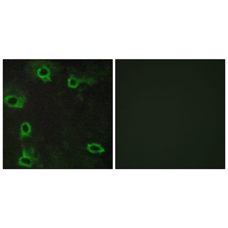 Immunofluorescence - Anti-ADORA2A Antibody (G020) - Antibodies.com