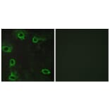 Immunofluorescence - Anti-ADORA2A Antibody (G020) - Antibodies.com