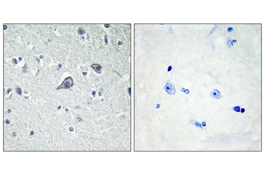 Immunohistochemistry - Anti-ADORA2A Antibody (G020) - Antibodies.com