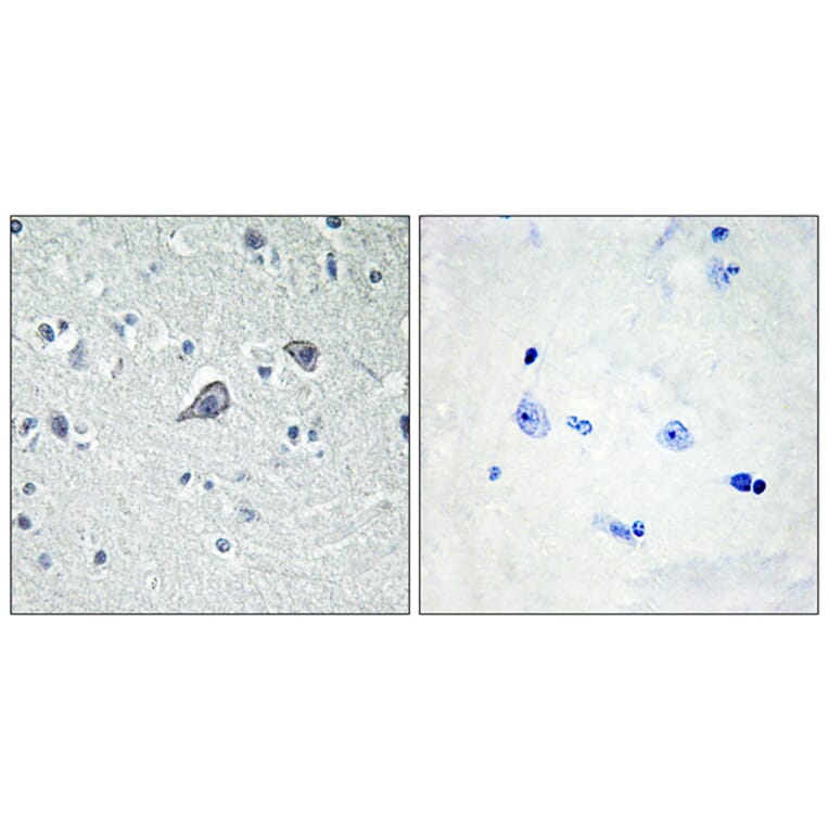 Immunohistochemistry - Anti-ADORA2A Antibody (G020) - Antibodies.com