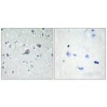 Immunohistochemistry - Anti-ADORA2A Antibody (G020) - Antibodies.com